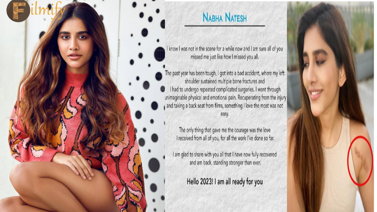 Nabha Natesh: After the accident again before the media.. Emotional comments viral..!